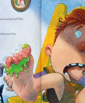 Alternative view of Bunion Burt