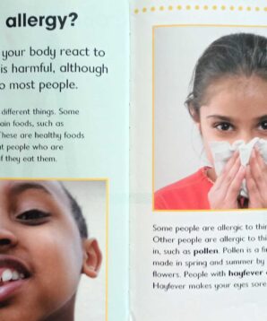 Alternative view of Allergies