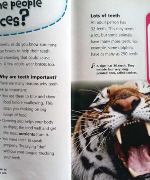 Alternative view of How do my braces work?