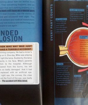 Alternative view of Lost sight: true survival stories